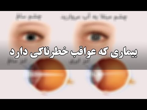 تصویری: همه چیز در مورد مرواریدها: نحوه ظاهر آنها