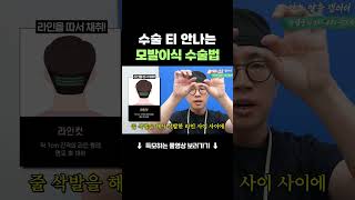 비절개 투블럭컷과 라인컷 장단점