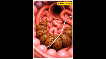 Your Colon Reacts to Constipation Like This (Visualized in 3D)