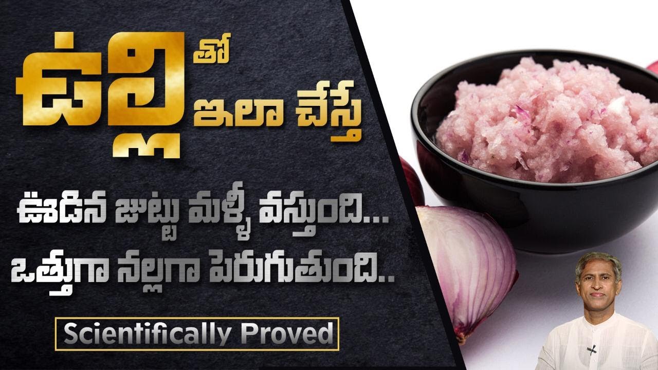 Onion for Hair Care | Home Remedy Onion for Hair Growth and Hair Fall |  's Beauty tips - YouTube
