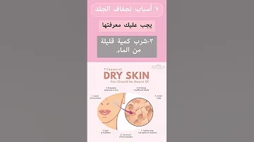 Dry Skin 7اسباب لجفاف البشرة Shorts 