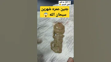 اول مره اشوف طفل عمره شهرين في بطن أمه 