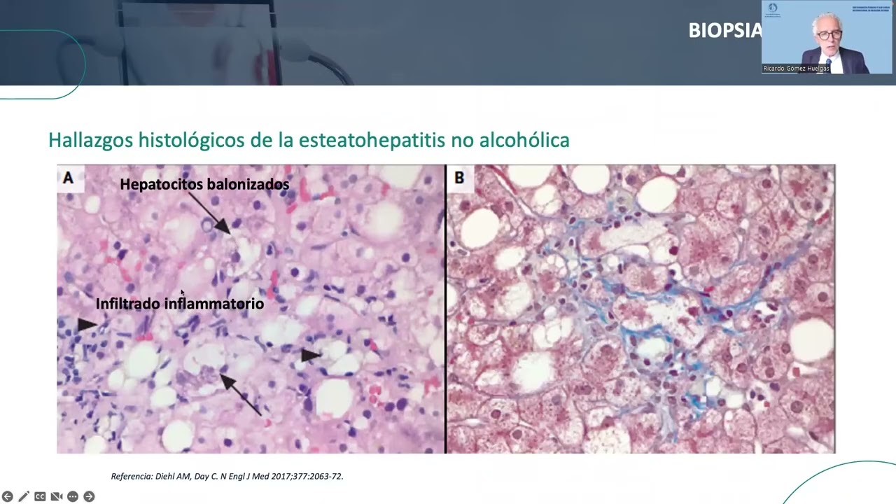 XXII CONGRESO SPMI SALA B 20/10/22 08:00 10:00