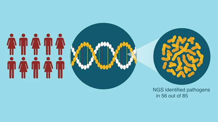 Understanding Culture-Negative PJI with Next-Generation Sequencing