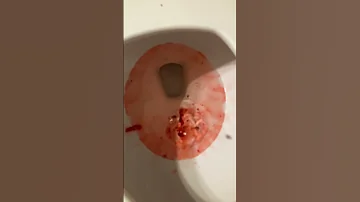 Just A Little Chunk Of Hope TW Fake Blood 