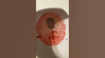 Thumbnail of Just a little chunk of hope… TW fake blood