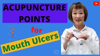 4 Acupuncture Points to cure Mouth Ulcers (Canker Sores) Youtube 2021