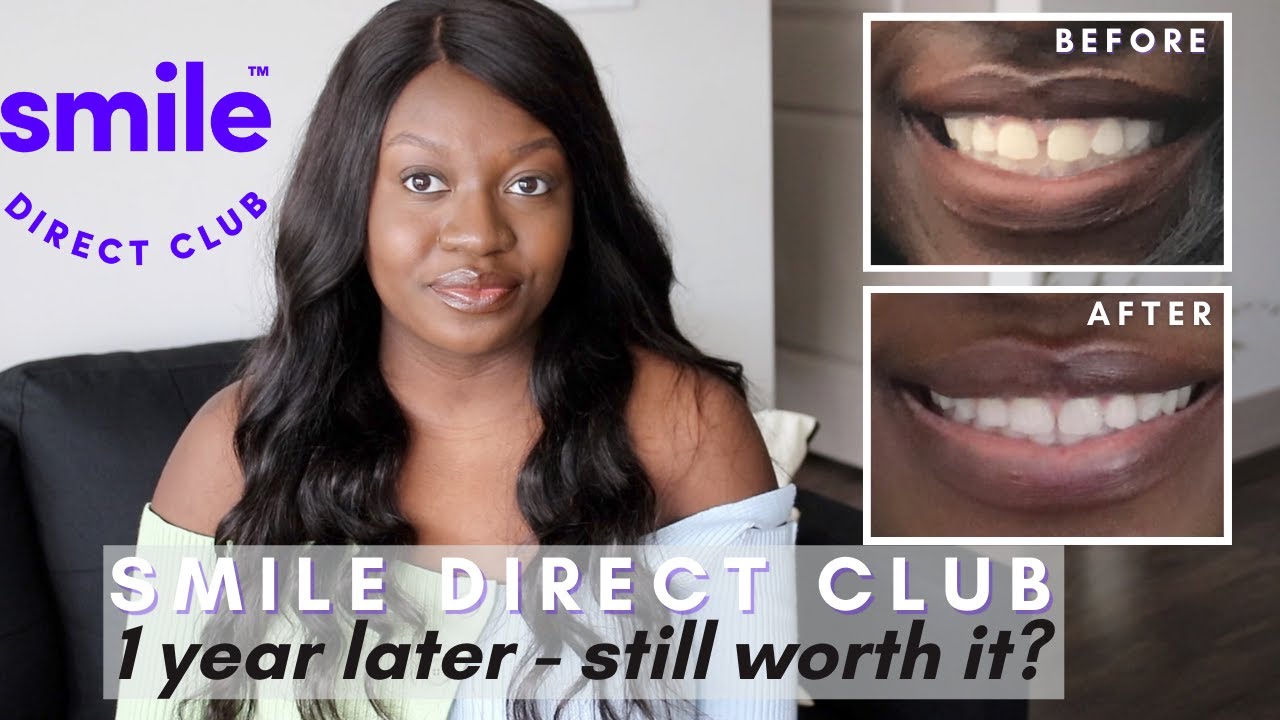 Can I Sue Smile Direct Club Smile Direct Club 1 Year Later - Still Worth It? | Teeth Straightening