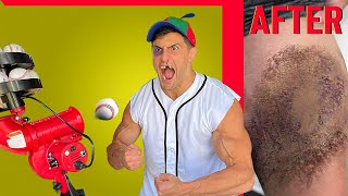 Creating the WORST BASEBALL INJURY of all Time | Bodybuilder VS Pitching Machine Experiment