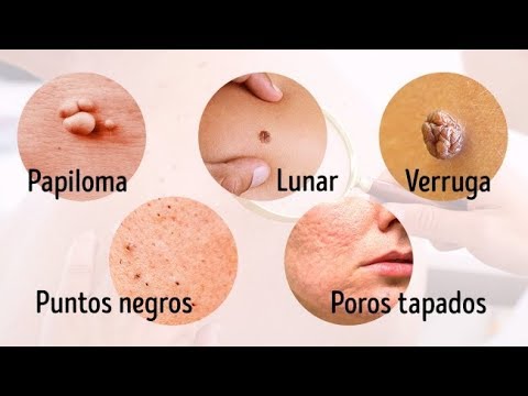 8 Problemas Serios Que Indica Nuestra Piel