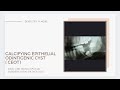 TUMORS PART 1 CEOT CALCIFYING EPITHELIAL ODONTOGENIC TUMOR PINDBORG TUMOR TUMORS PART 1 CEOT CALCIFYING EPITHELIAL ODONTOGENIC TUMOR PINDBORG TUMOR