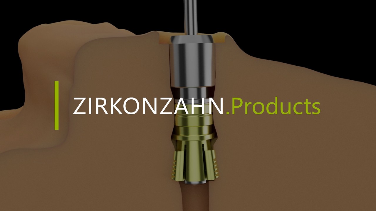 Anwendung der PrintAnaloge | Zirkonzahn.Products