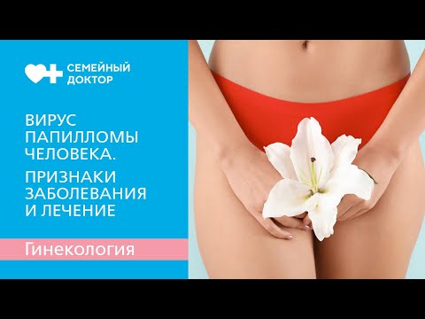 Вирус папилломы человека. Признаки заболевания и лечение.