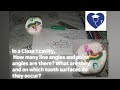 line angel point angle class 1 cavity:  What are they, and on which tooth surfaces do they occur?
