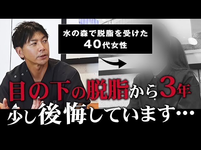 【クマ取り】目の下の脱脂って実際どうなの？体験者のリアルな感想を公開します【水の森美容クリニック】