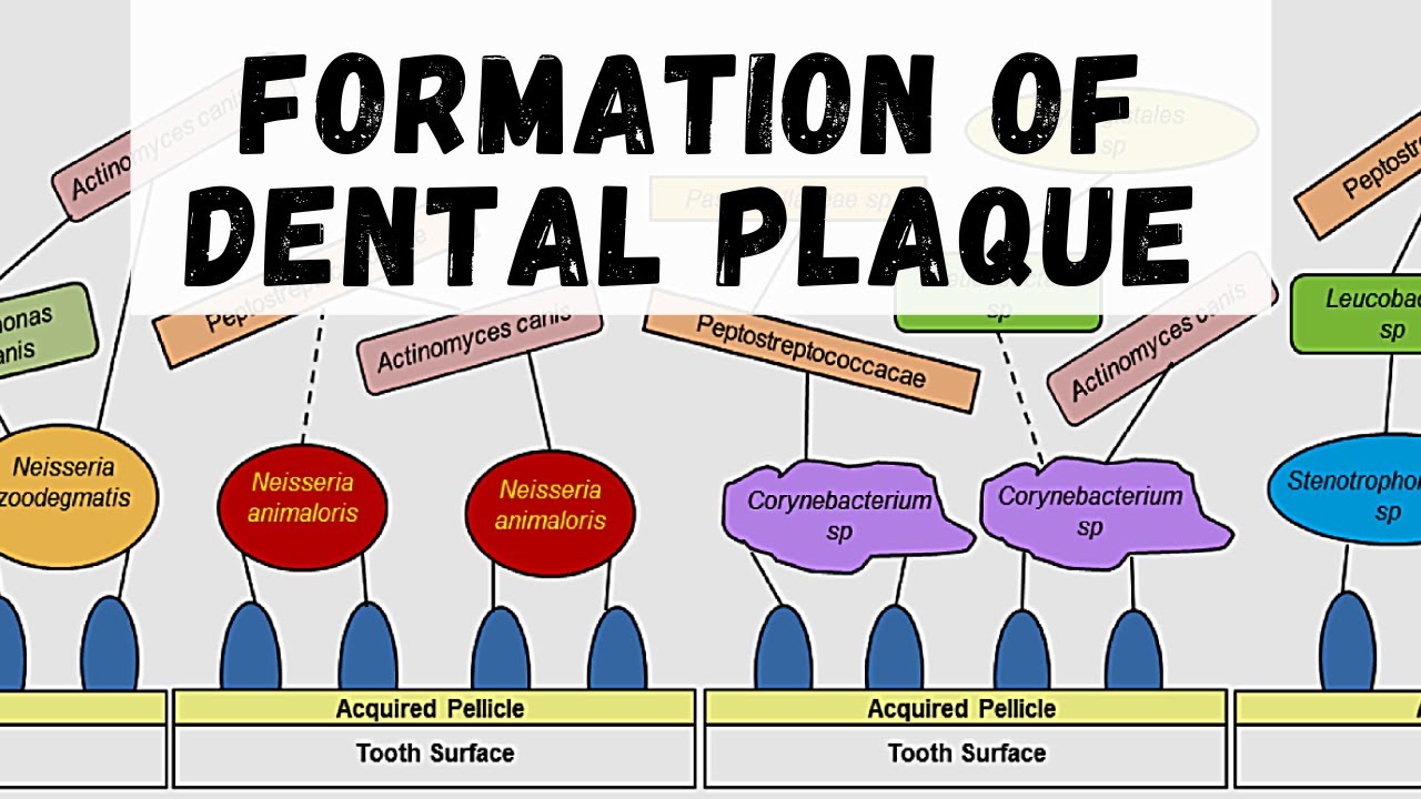 FORMATION OF DENTAL PLAQUE ( Dental Plaque Part 2 ) YouTube