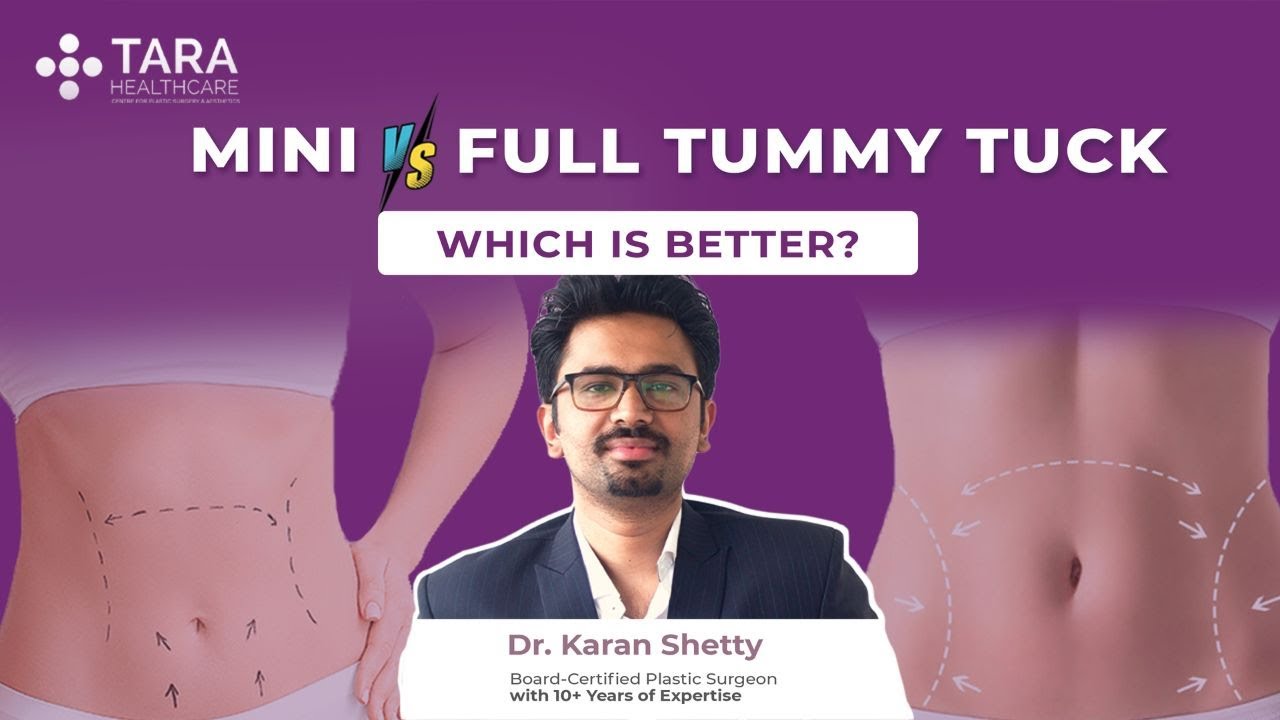 Mini Tummy Tuck vs Full Tummy Tuck: What’s the Difference?