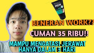 BEKAS JERAWAT HILANG DENGAN CEPAT PAKAI CARA INI!!!