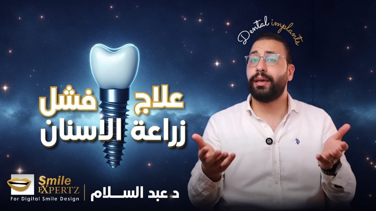 علاج فشل زراعة الأسنان وأسبابه | دكتور عبد السلام يوضح أهم الحلول والوقاية