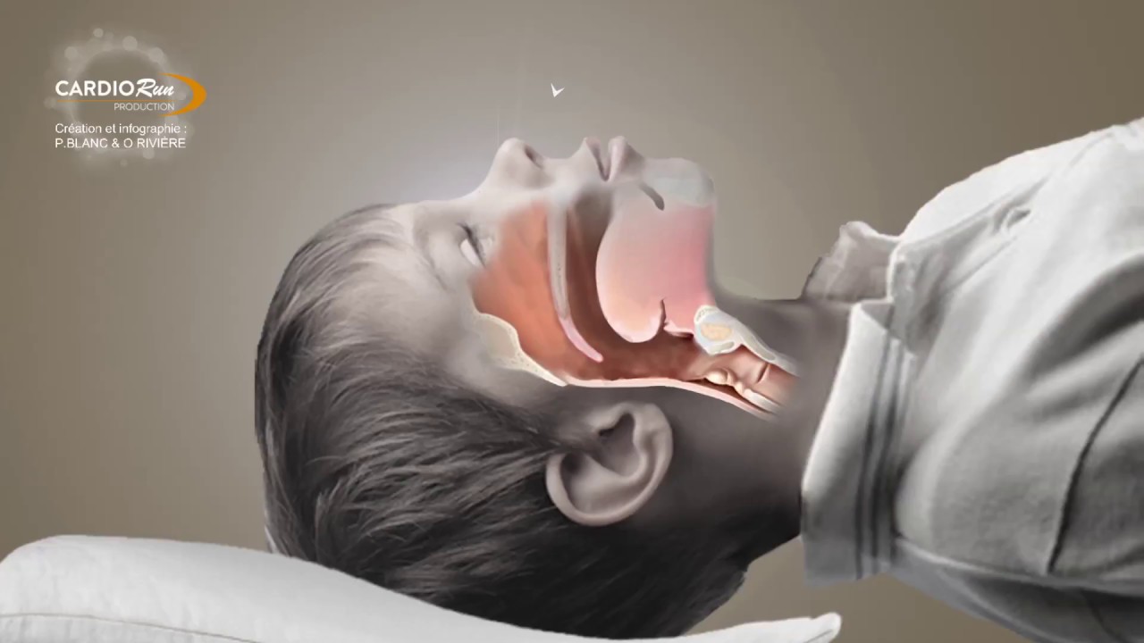 SAS enfant animation - YouTube