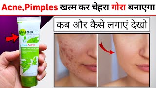 Garnier Pure Active Neem Purifying Face Wash Review | garnier pure active face wash