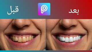 كيفية عمل تأثير تغيير لون الأسنان في برنامج البيكس آرت/picsart tutorial screenshot 1