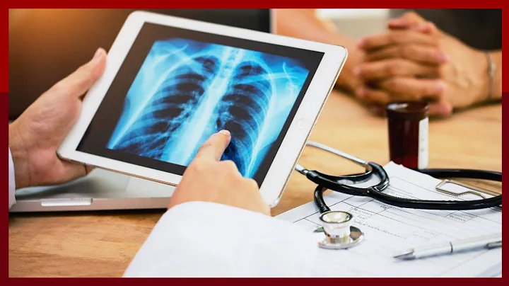 Robotic-Assisted Thoracic Cancer Surgery