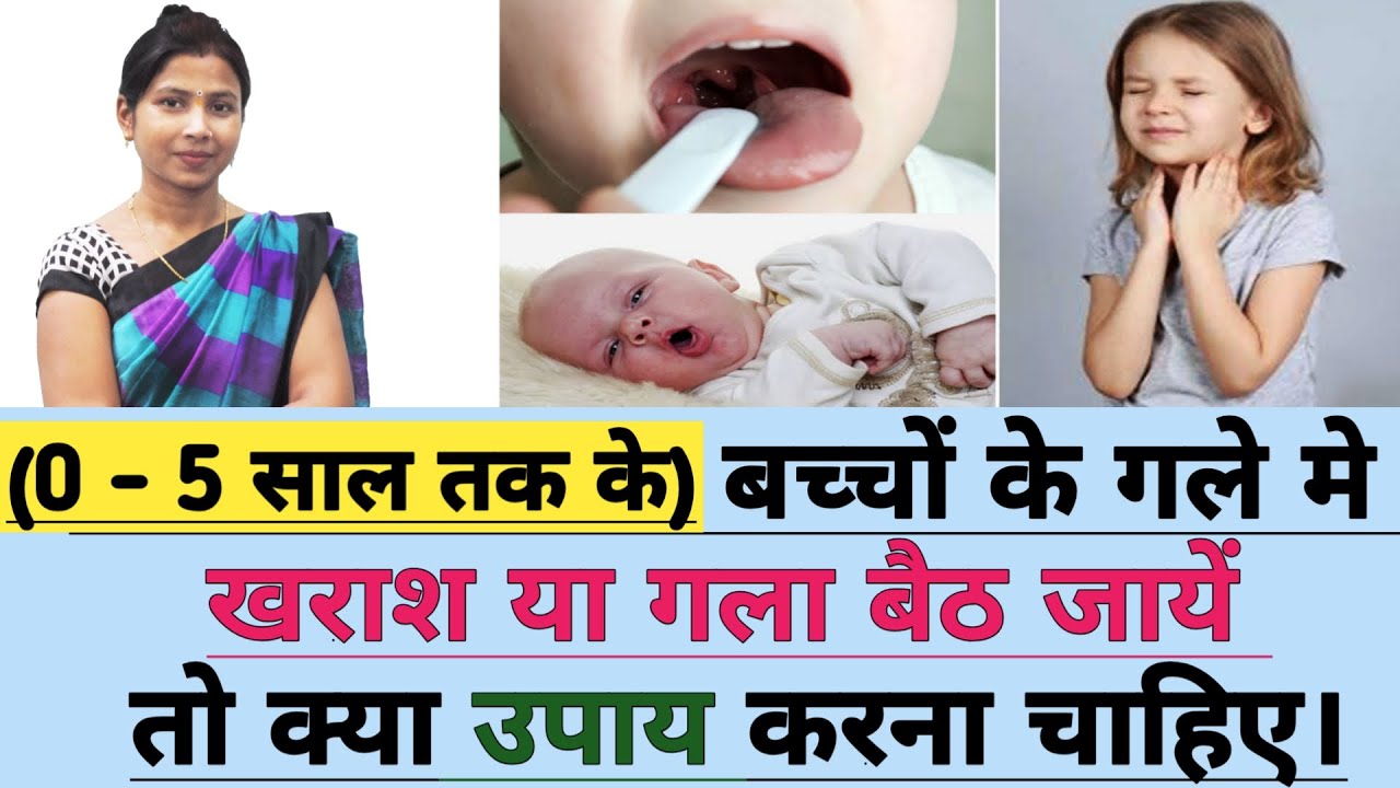 बच्चों के गले मे खराश या गला बैठ जाये तो क्या उपाय करे। Chote bacho ka gala kharab ka ilaj.