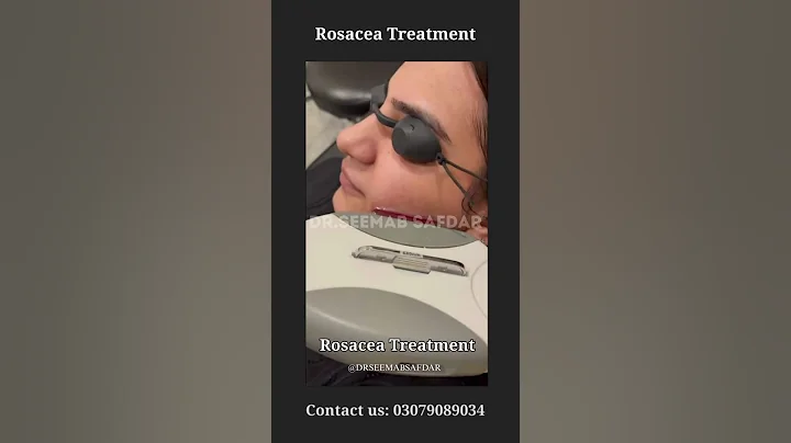 Rosacea treatment ✨ clear glowing skin 🌸 visible results #skincare #foryou #glow #trending #fypシ