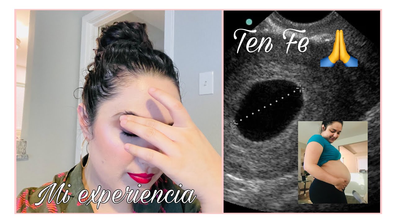 Empty Sac pregnancy//STORY TIME EMBARAZO ANEMBRIONADO Y EXPULSION + COMO ME EMBARAZE