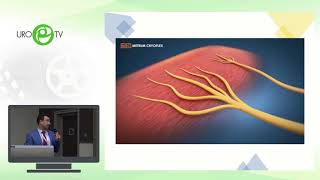Криоденервация дорсального нерва для лечения преждевременной эякуляции - лекция Якова Миркина