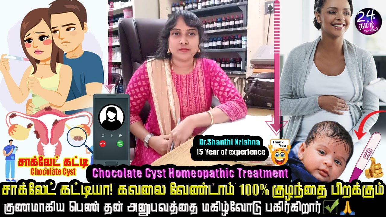 சாக்லேட் கட்டியால் குழந்தை இல்லயா! 3 மாதத்தில் தீர்வு chocolate cyst