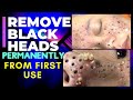 How To Get Rid of Blackheads On Nose 4 IMPORTANT STEPS! Remove Blackheads PERMANENTLY