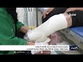مشروع مسام السعودي ينزع الألغام الحوثية ومركز الملك سلمان للإغاثة يوفر أطرافاً صناعية للمبتورين