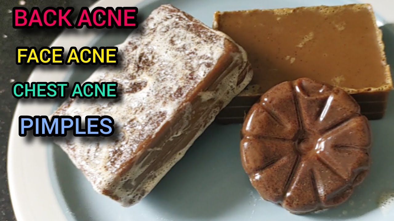 Home made cloves and cinnamon soap to dry pimples, acne and exfoliate the skin./Back acne/chest acne