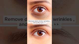 Easy way to fix black circles. dark circles removal remedy✨ #darkcircles #eyecare #foryou #youtube