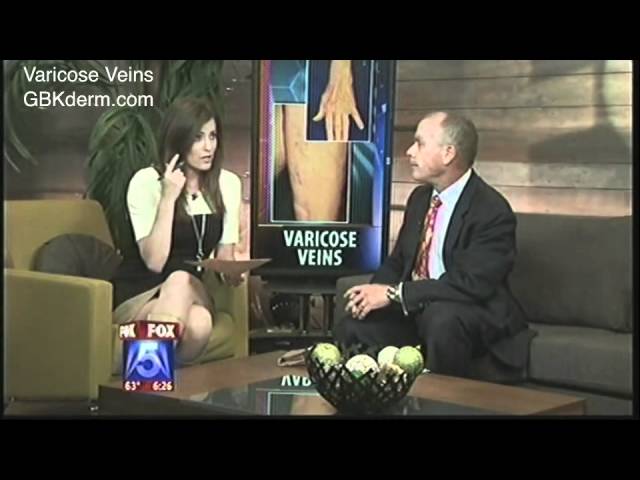 Banner for Varicose Veins | Spider Vein Treatment | Dr. Goldman
