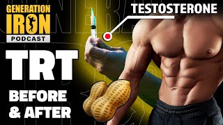 Before &amp; After Using TRT: Pros &amp; Cons Of Testosterone Replacement Therapy | GI Podcast