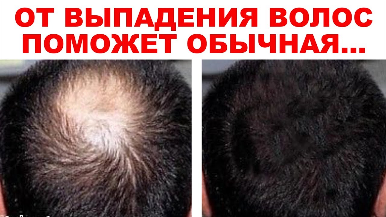 Смотреть Ваши волосы будут расти, как сумасшедшие, а зрение будет, как у орла Употребляйте 3 столовые ложки и произойдет чудо видео Смотреть Ваши волосы будут расти, как сумасшедшие, а зрение будет, как у орла Употребляйте 3 столовые ложки и произойдет чудо видео