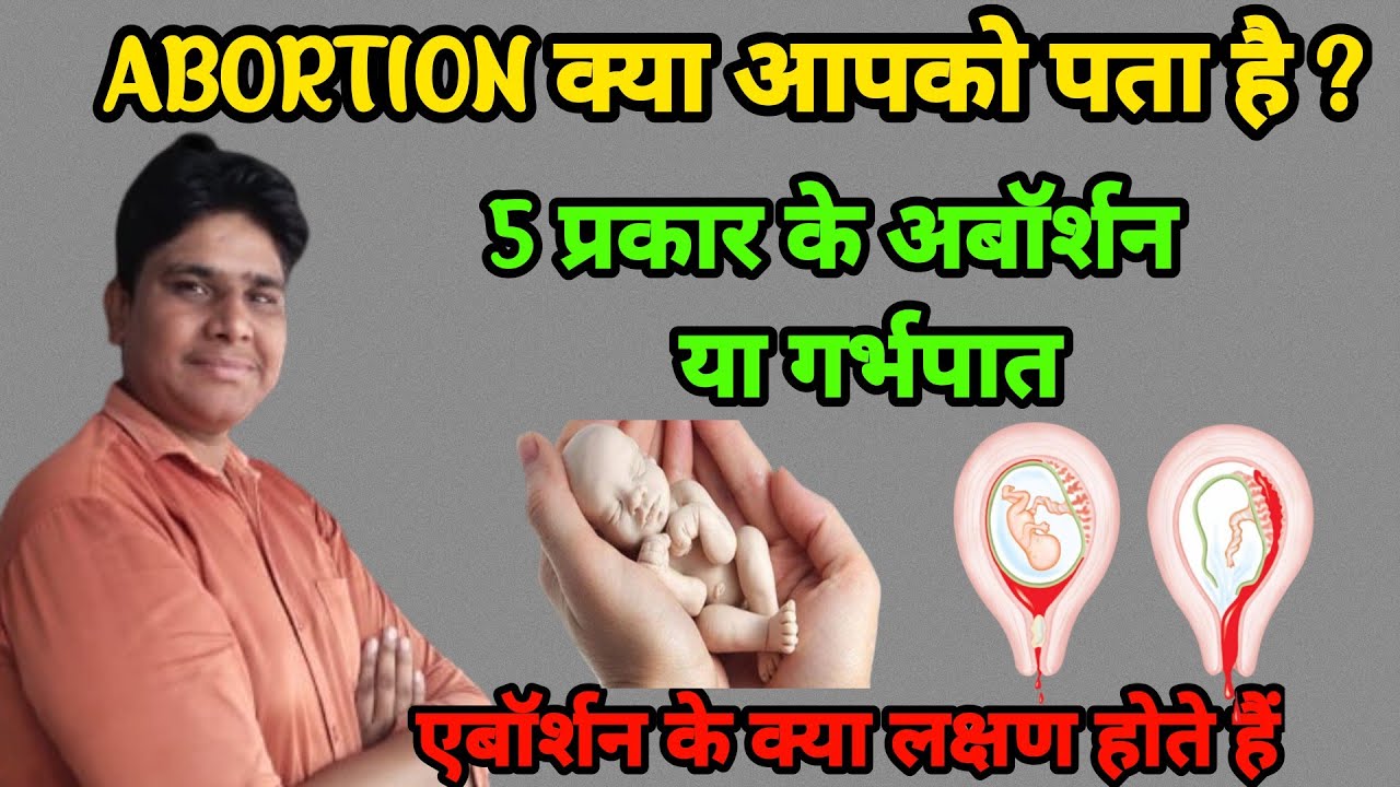 Miscarriage kaise hota hai Miscarriage symptoms Miscarriage