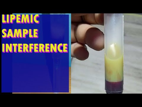Video: Utječe li lipemija na mcv?