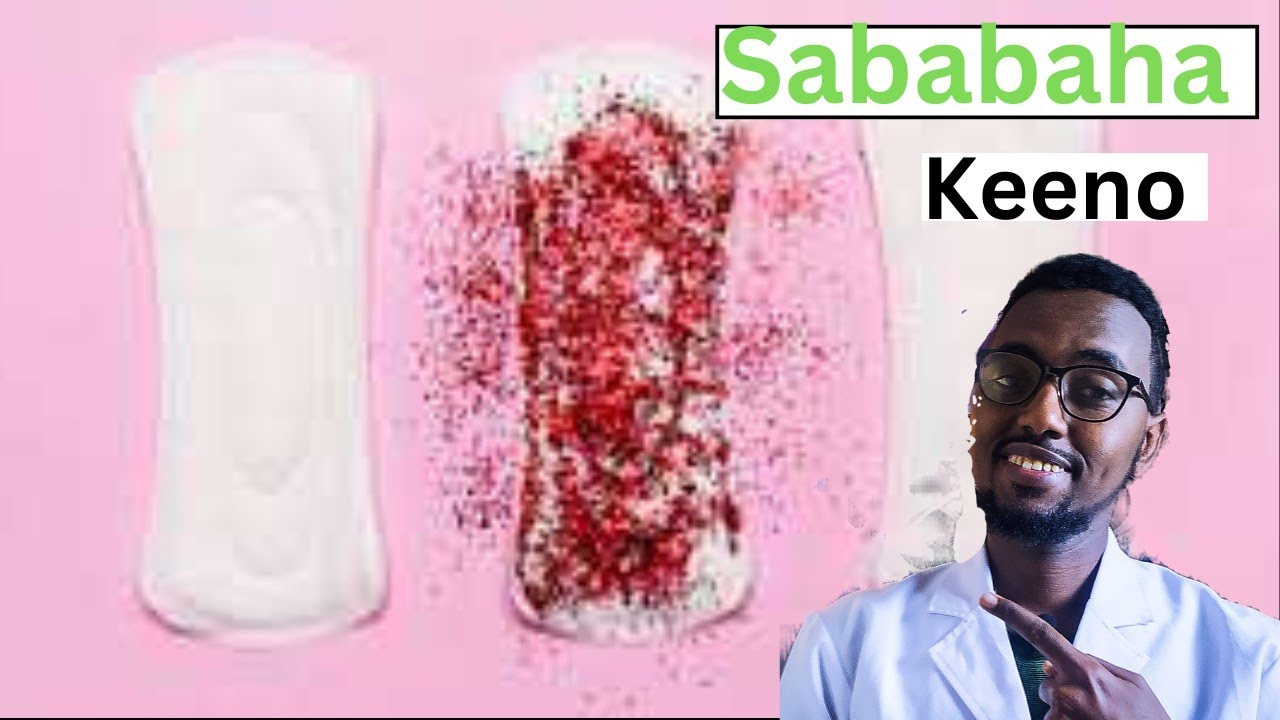 Sababaha Keeno Diiga 3-bilood ugu Horeysa Uurka!