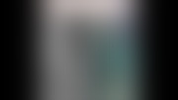 Salvaging non Salvageable- Massive soft tissue loss, 15cm bone gap