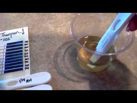 Video: Si të bëni një test të ngjyrosjes septike?