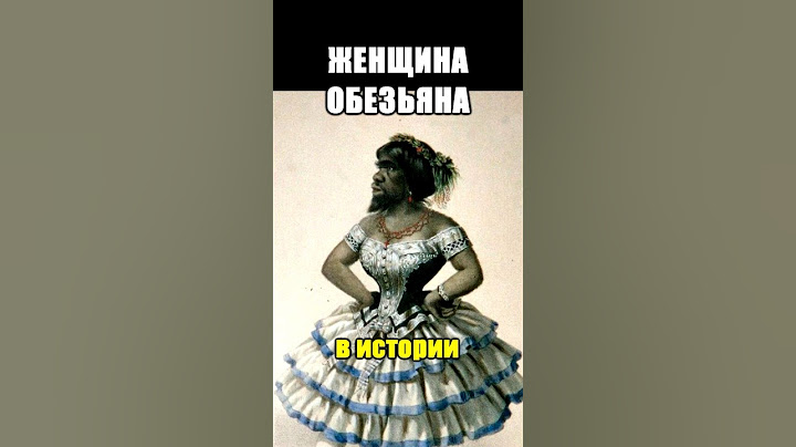 Трагичная история САМОЙ НЕКРАСИВОЙ ЖЕНЩИНЫ В ИСТОРИИ