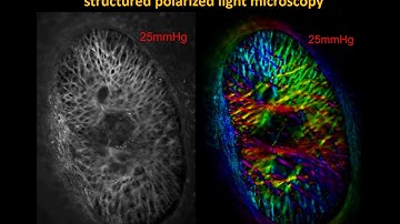 Structured polarized light microscopy