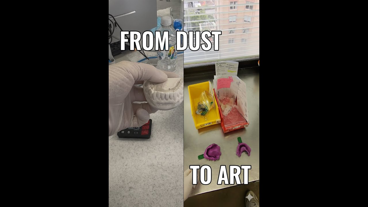 From Liquid to Solid: Mastering the Art of Dental Stone 🦷