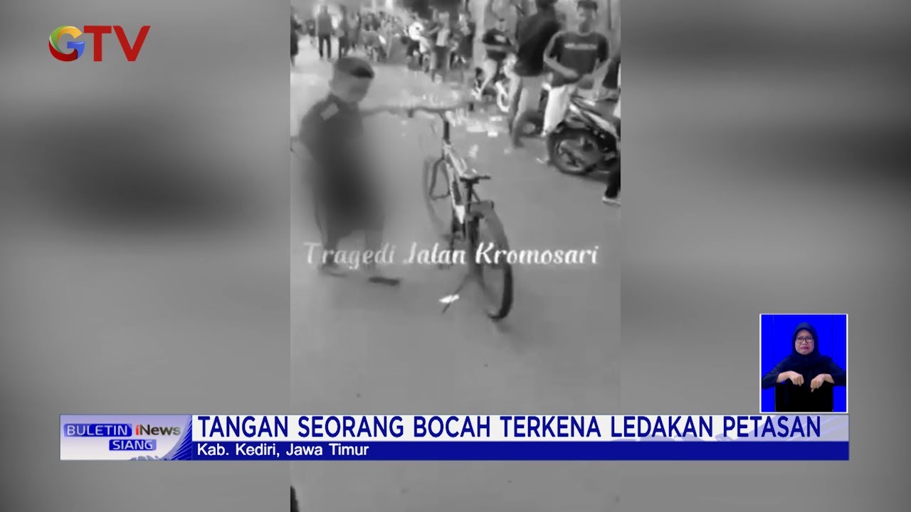 Tangan Seorang Bocah Terluka Akibat Terkena Ledakan Petasan di Kediri #BuletiniNewsSiang 25/04