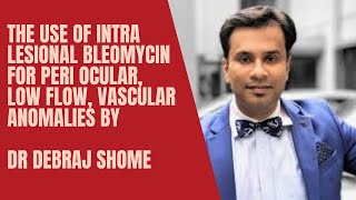 The Use Of Intra Lesional Bleomycin For Peri Ocular, Low Flow, Vascular Anomalies- Dr Debraj Shome