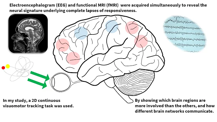 Physiological mechanisms of endogenous attention lapses & microsleeps (People's Choice Award winner) - DayDayNews